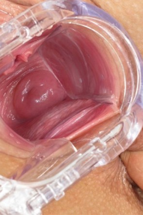 Голая вагина изнутри (60 фото)