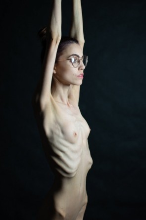 Порно модели анорексия (82 фото)