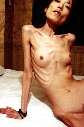 Анорексия голые (61 фото)