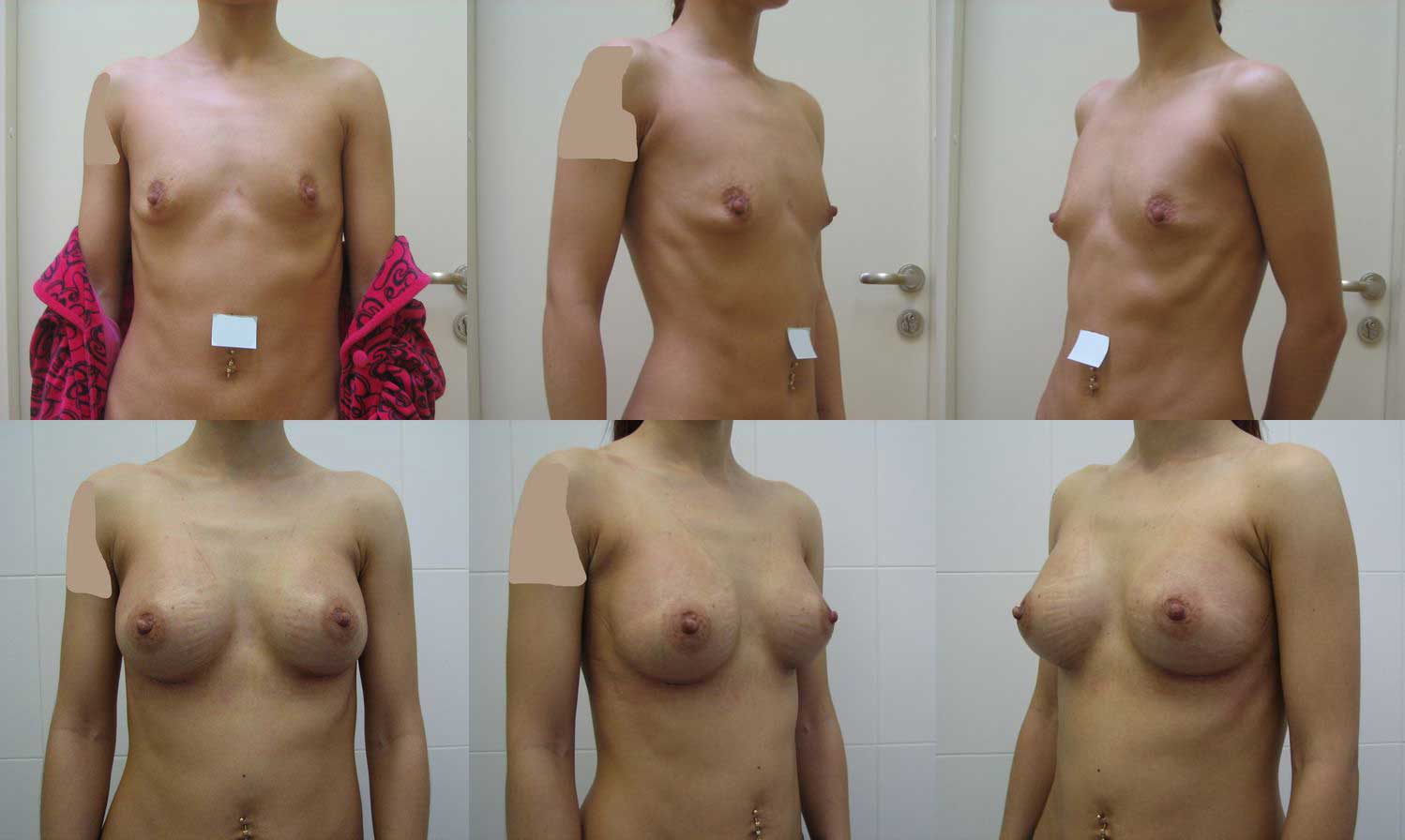 увеличивается грудь у женщин фото 10
