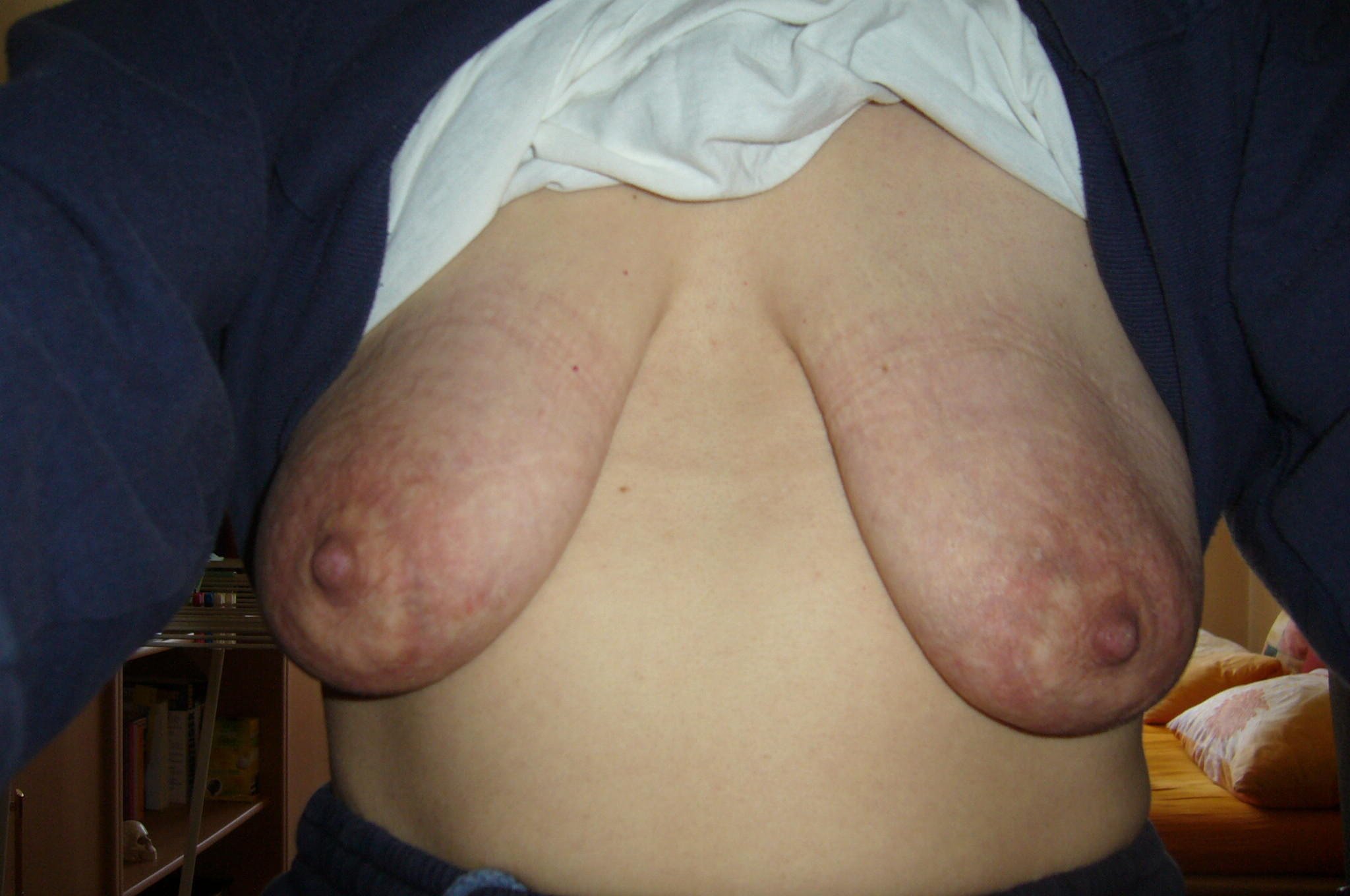 некрасивая грудь у женщин фото 107